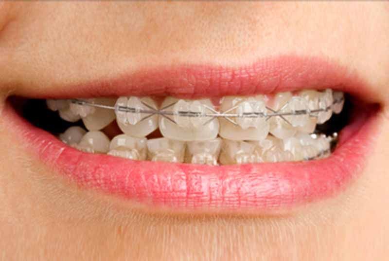Clínica Dental Dr. Touris Carrera y Dra. Torre Celada tratamiento odontológico